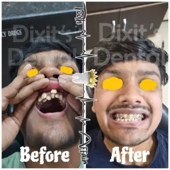 Patient treatment result