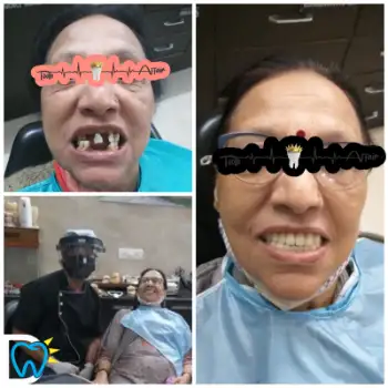 Patient treatment result