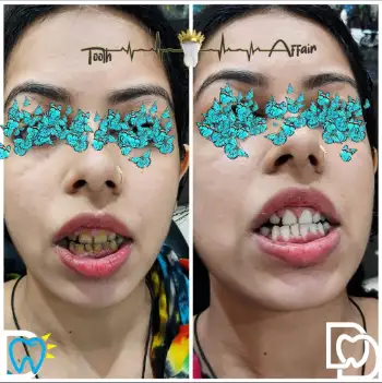Patient treatment result