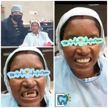 Patient treatment result