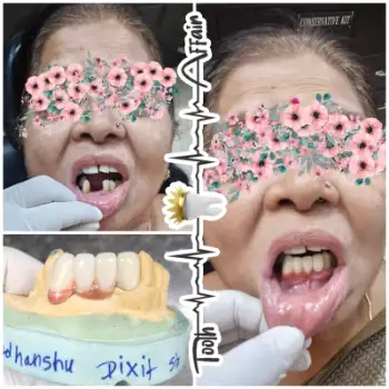 Patient treatment result