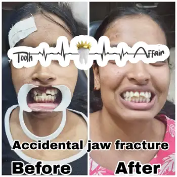 Patient treatment result