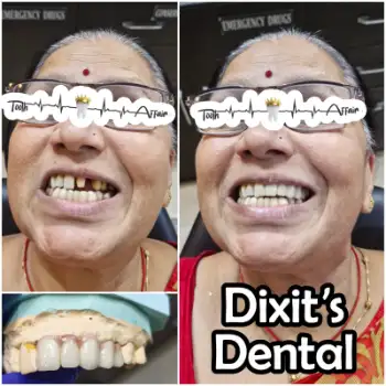 Patient treatment result