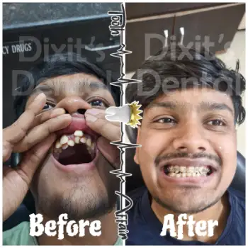 Patient treatment result