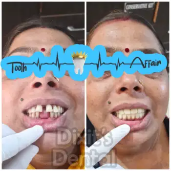 Patient treatment result