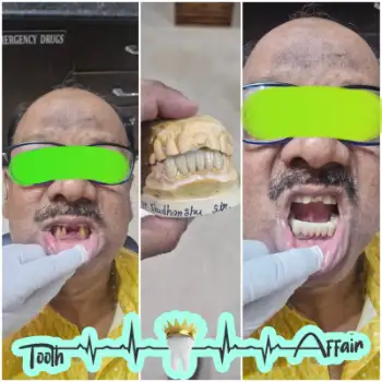 Patient treatment result