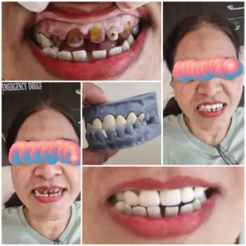 Patient treatment result
