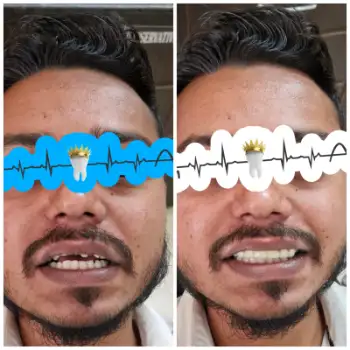 Patient treatment result