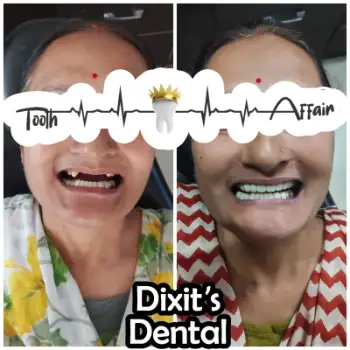 Patient treatment result