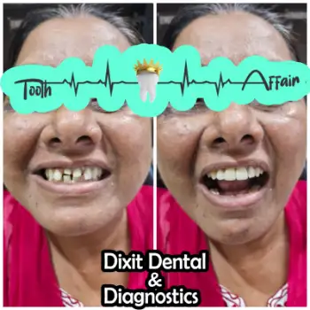 Patient treatment result