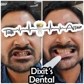 Patient treatment result