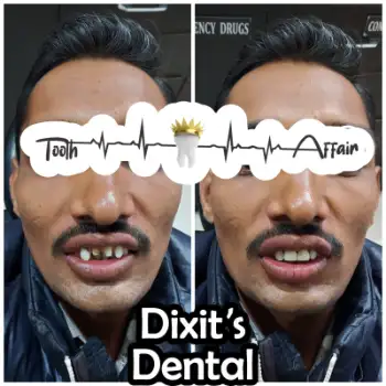 Patient treatment result