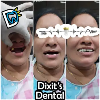 Patient treatment result