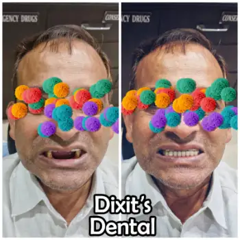 Patient treatment result