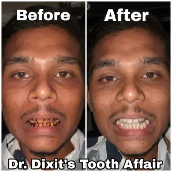 Patient treatment result