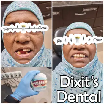 Patient treatment result