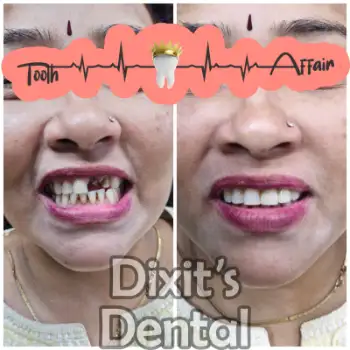 Patient treatment result