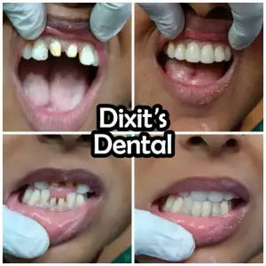 Patient treatment result