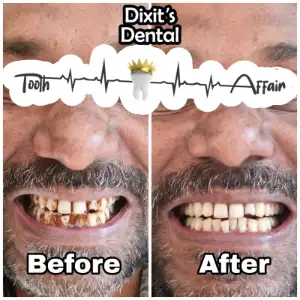 Patient treatment result