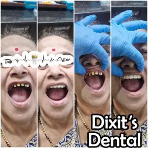 Patient treatment result