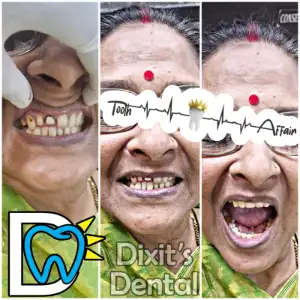 Patient treatment result