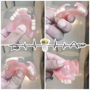 Patient treatment result