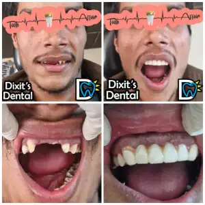 Patient treatment result