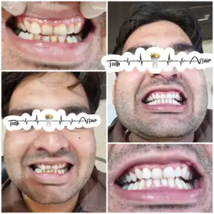 Patient treatment result