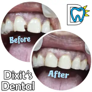 Patient treatment result