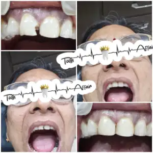 Patient treatment result