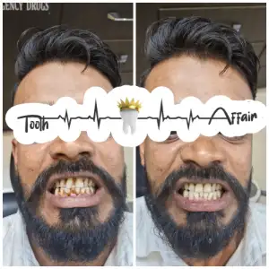 Patient treatment result