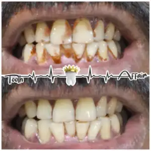 Patient treatment result