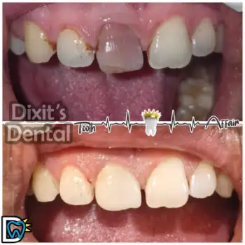 Patient treatment result